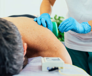 Biomedical Dry Needling